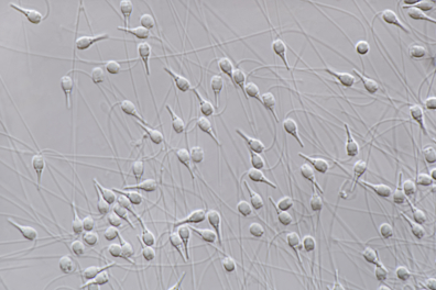 Spermatozoïdes de la Moule (Mytilus edulis) x280